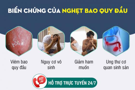 1758942040594361.jpg nghet-bao-quy-dau-o-nam-gioi-2.jpg